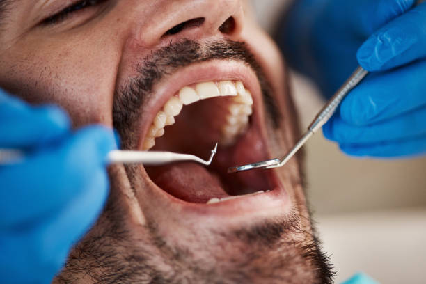 Best Dental Bonding  in Escobares, TX